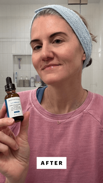 Bailly after applying the SkinCeuticals C E Ferulic